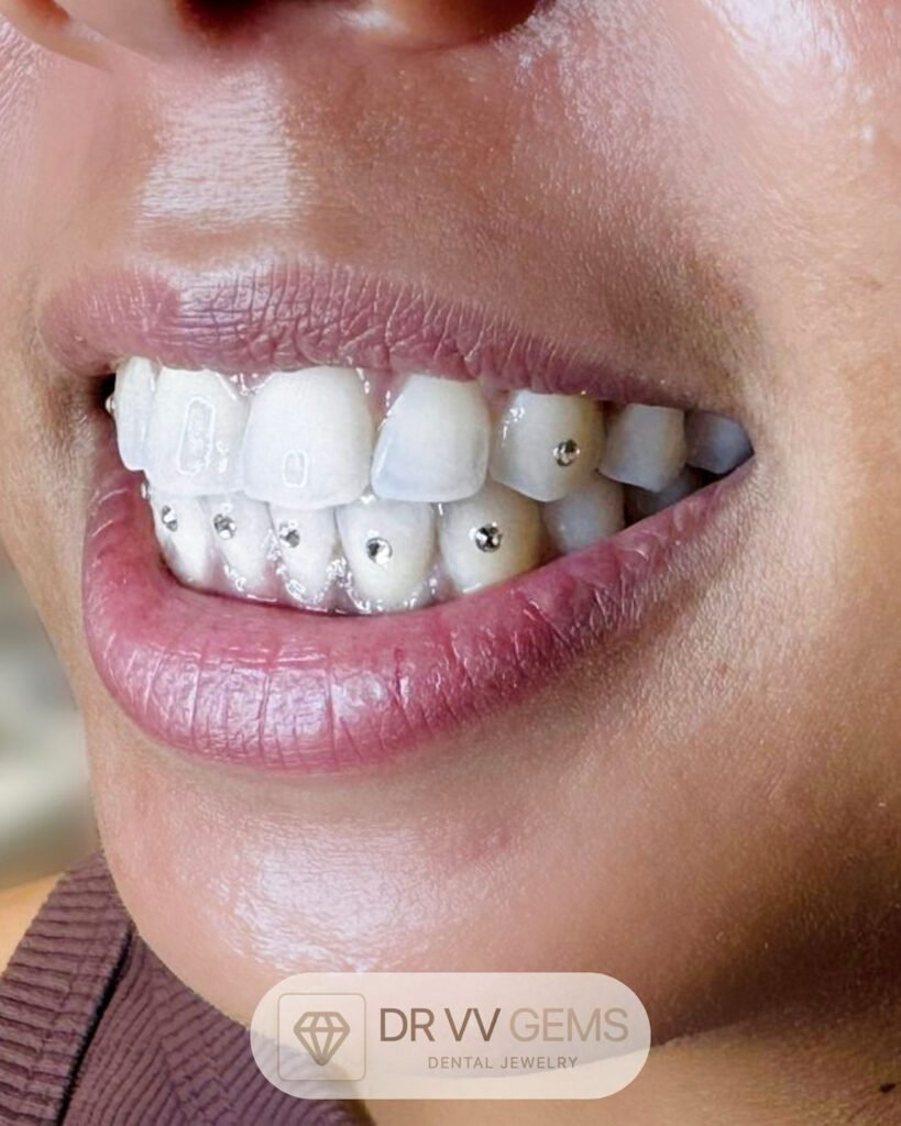Formation en pose de strass dentaire encadrée par une dentiste